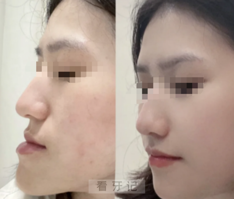 025最新国内正畸正颌医生权威盘点！附广东、上海、北京、福建、江苏、杭州等口腔医院正颌手术价目表！"