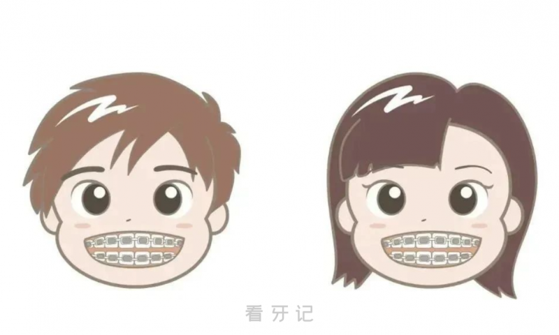 正畸牙套价格大揭秘！3千的牙套和3万的牙套有什么区别？金属、陶瓷、舌侧、隐形牙套哪个好？正畸医生应该怎么选？正畸小白必看！附2025最新矫正器价格表