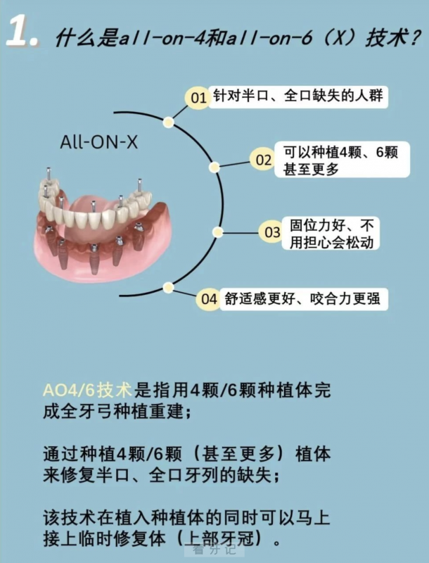 四张图片请收藏！半口全口种植为什么选择all-on-4和all-on-6方案？全网最全分析图文攻略