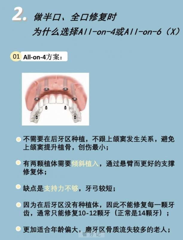 四张图片请收藏！半口全口种植为什么选择all-on-4和all-on-6方案？全网最全分析图文攻略