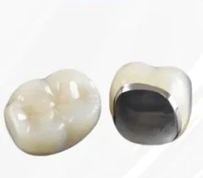 在职牙医分享看牙真相！到底要不要带牙冠？牙冠多少钱一颗？全瓷/烤瓷/金属冠该怎么选？牙冠寿命有多久？牙冠最全避坑指南！赶快收藏！