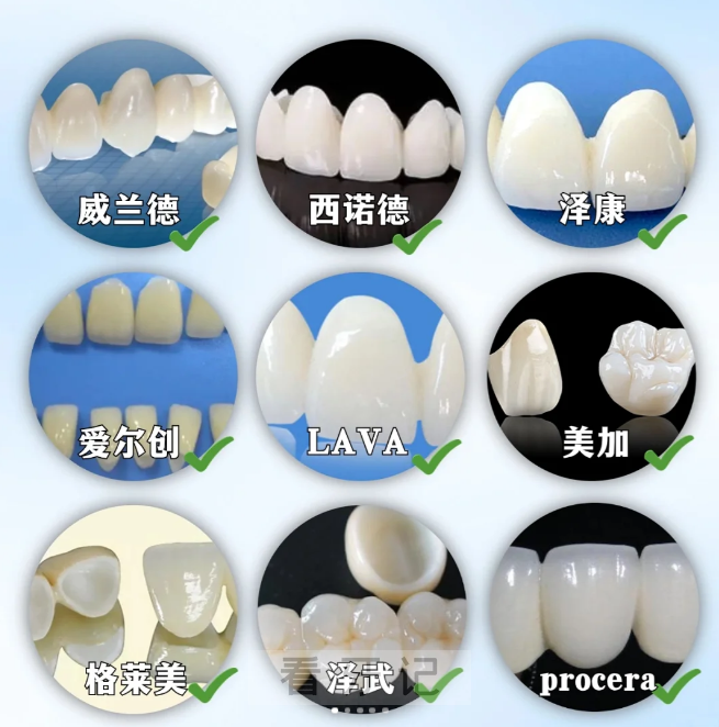 做牙冠后悔死了？这篇全瓷牙攻略请收好，千元内也能选到合适的！牙冠多少钱一颗？牙冠的寿命多久？全瓷/烤瓷/金属牙冠怎么选？附牙冠价格