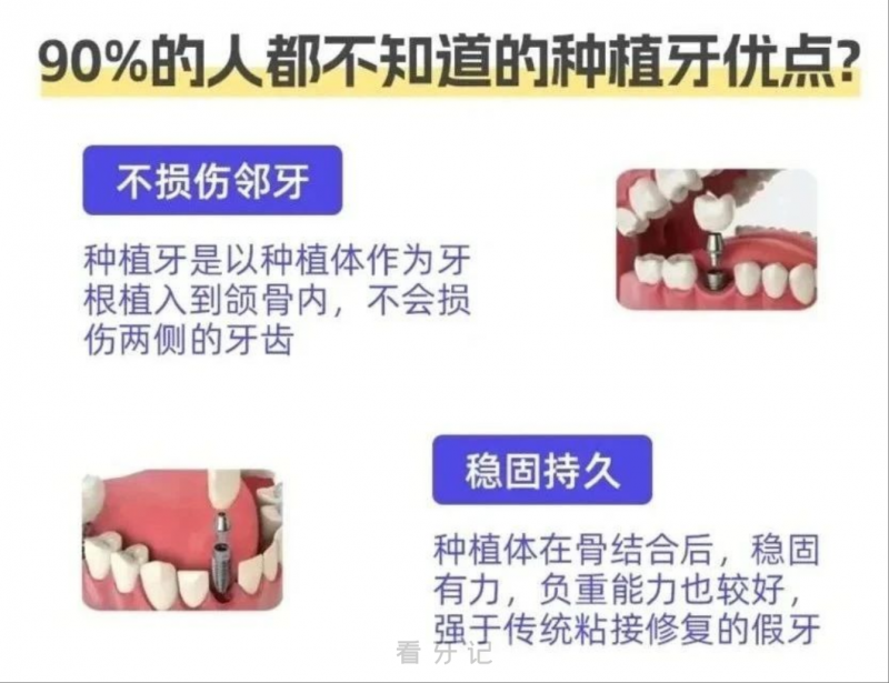 为什么还是有很多人做了活动假牙而不种牙！因为90%的人都不知道的种植牙优点！