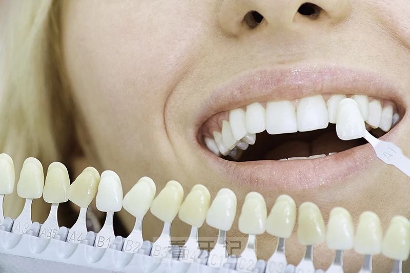 贝睿全瓷牙是国产还是进口？属于什么档次级别？靠不靠谱？
