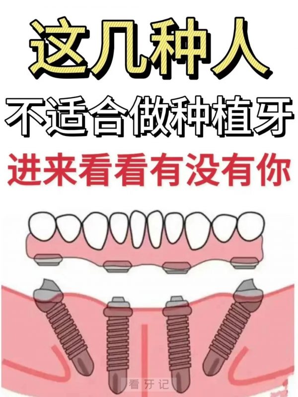 种牙血泪忠告！不适合的人千万别尝试种植牙！一些黑心私立口腔医生绝不会告诉你的禁种人群和价格陷阱