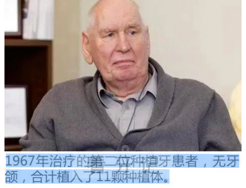 用真实数据告诉你种植牙到底可以用多少年?