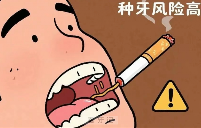 口腔行业摸爬滚打好些年！掏心窝子说点大实话！太多人种牙最后却落得钱花了罪受了的下场