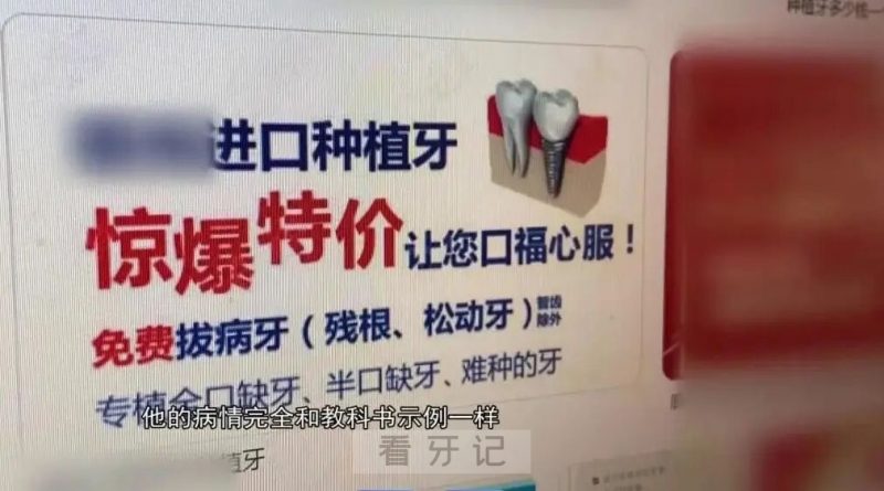 99元一颗的种植牙种到嘴巴里靠谱吗？低价种植牙三大陷阱与避坑指南你必须要知道！"