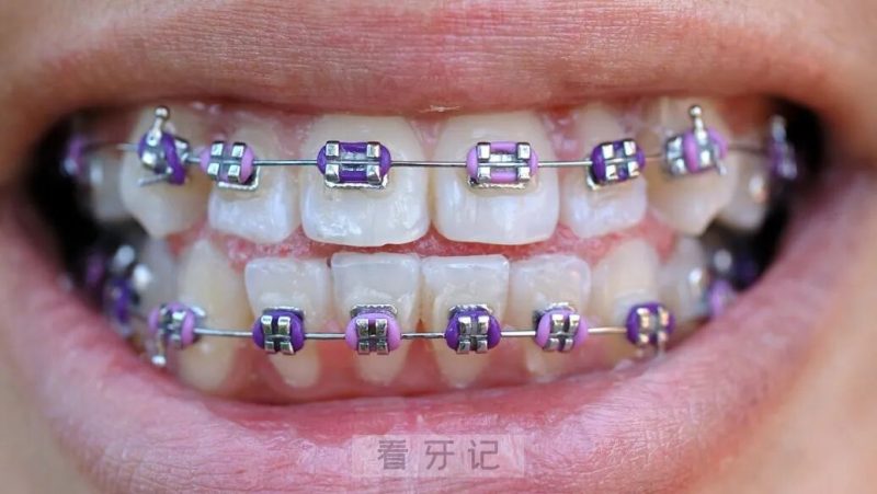 良心牙医忠告千万别冲动正畸！先搞明白你需要做牙齿矫正吗？正畸要花多少钱？矫正流程是什么？如何挑选靠谱的医院＋医生？附2025年牙齿矫正价格表