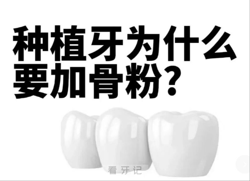 医生说我的牙必须要加骨粉是不是忽悠我多交钱？做种植牙为啥要加骨粉？来了解一下骨粉的知识~