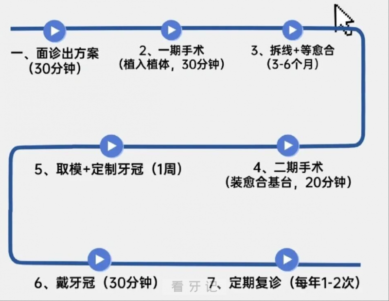 种牙到底要多久？种牙到底要跑几次医院？流程复杂吗？医生催我当天种牙要不要种？揭秘低价种牙套路