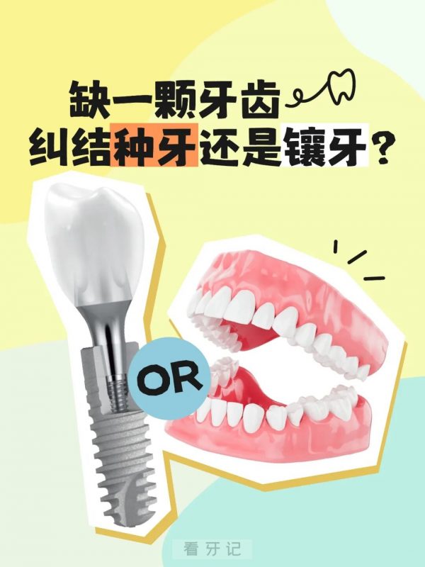 如何看待种植牙？种植牙和镶牙哪个好？种植牙是“奢侈品”还是生活“必需品”？