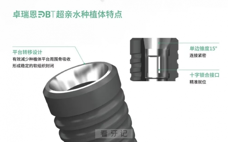 百齿泰旗下卓瑞恩DRBT系列超亲水种植体介绍
